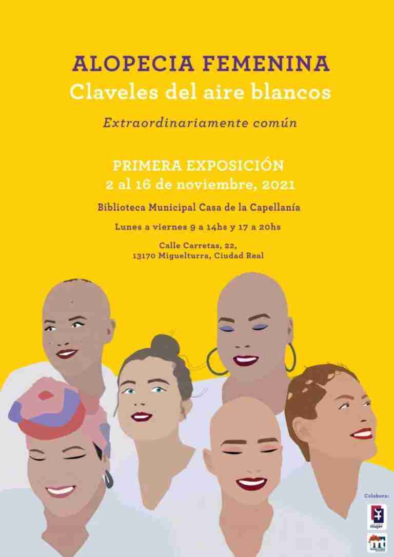 exposicioin alopecia femenina miguelturra