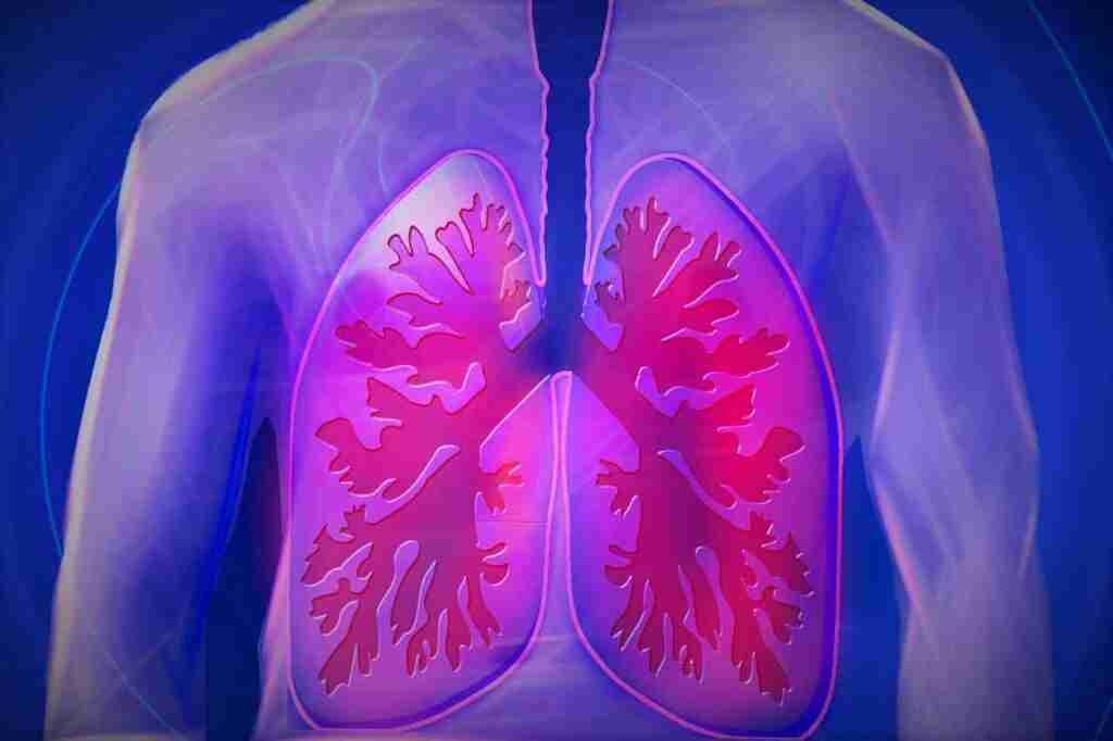 Ocho asociaciones de fibrosis quística participan en un proyecto de la Federación Española de FQ para mejorar su gestión de calidad 9 Ocho asociaciones de fibrosis quística participan en un proyecto de la Federación Española de FQ para mejorar su gestión de calidad 7