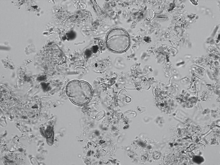 Imagen ampliada en blanco y negro del polen