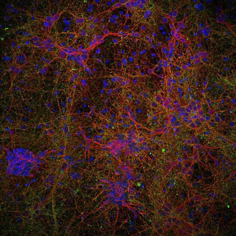 Parapléjicos participa en una investigación del CSIC sobre estudio de la nanotecnología para reparar lesiones medulares