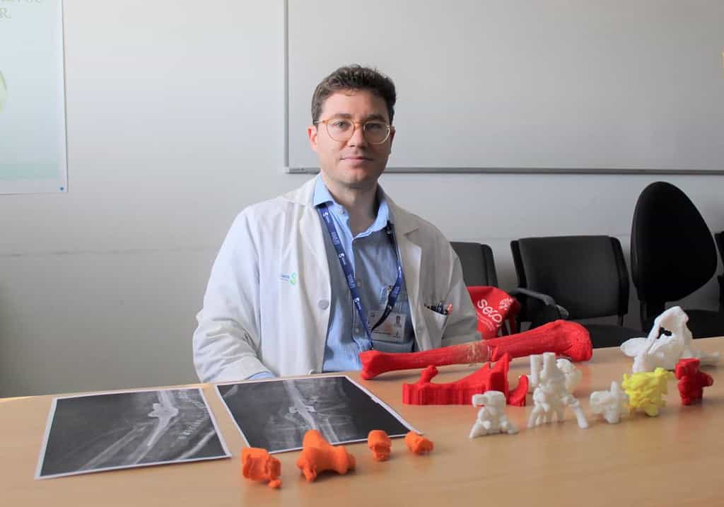 El Hospital de Ciudad Real incorpora la impresión 3D para planificar las intervenciones en traumatología