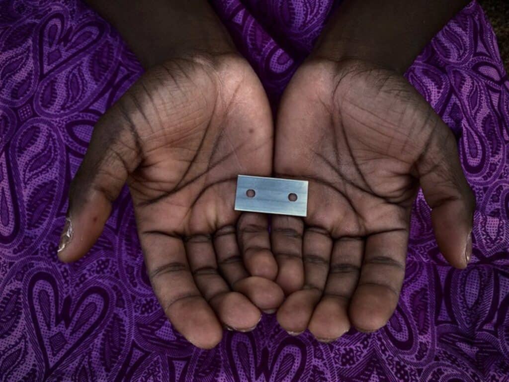 Este martes se abre el plazo para solicitar ayudas a la sensibilización y prevención de la mutilación genital femenina