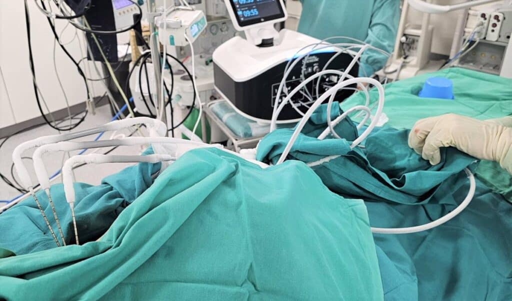 El hospital de Ciudad Real incorpora una nueva técnica para eliminar lesiones tumorales complejas mediante congelación