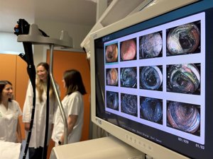 El Hospital de Almansa, a la vanguardia regional en la detección precoz de lesiones digestivas mediante cromoendoscopia